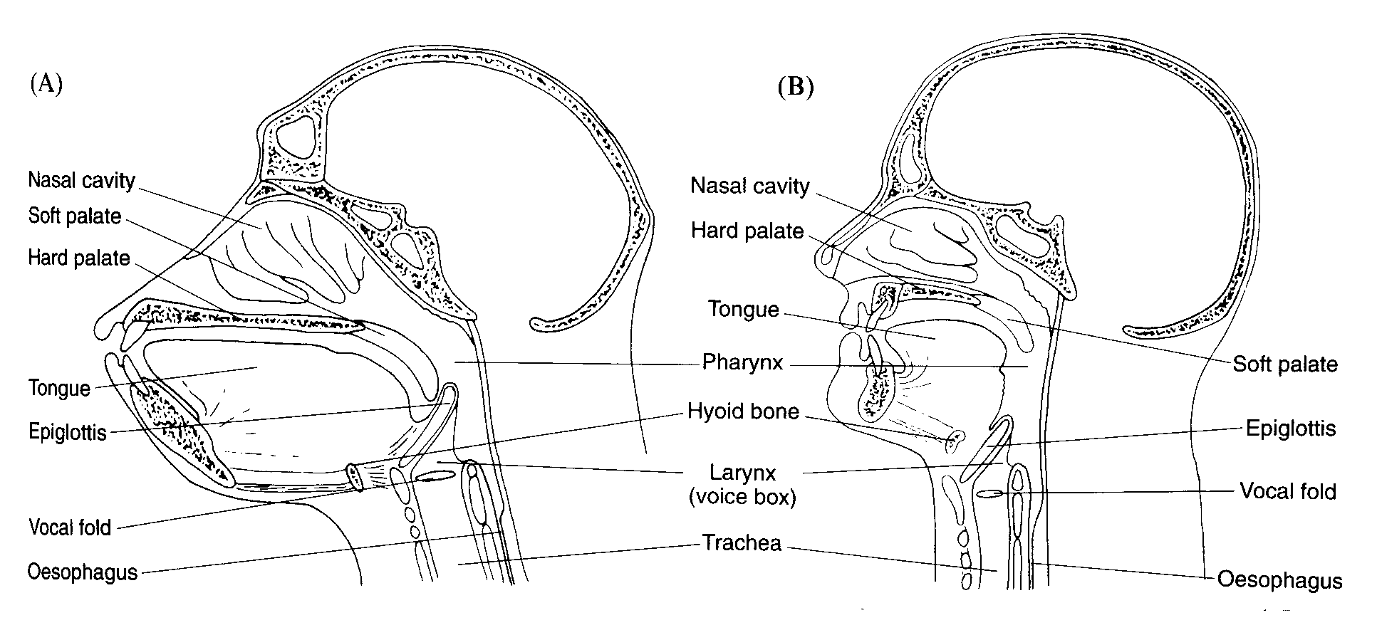 Descended Larynx